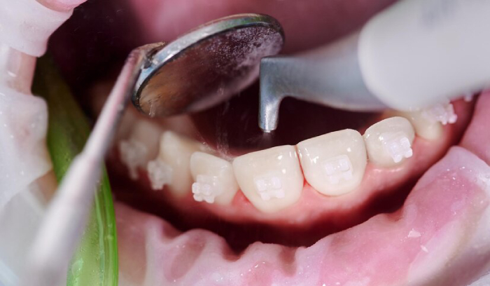 sonoma county dentist
